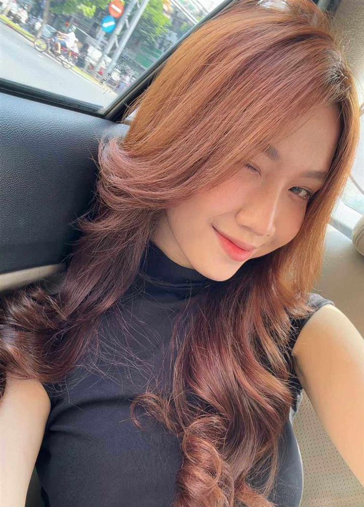 Mỹ nữ kế nhiệm Hương Giang tự công khai quá trình phẫu thuật thẩm mỹ-1