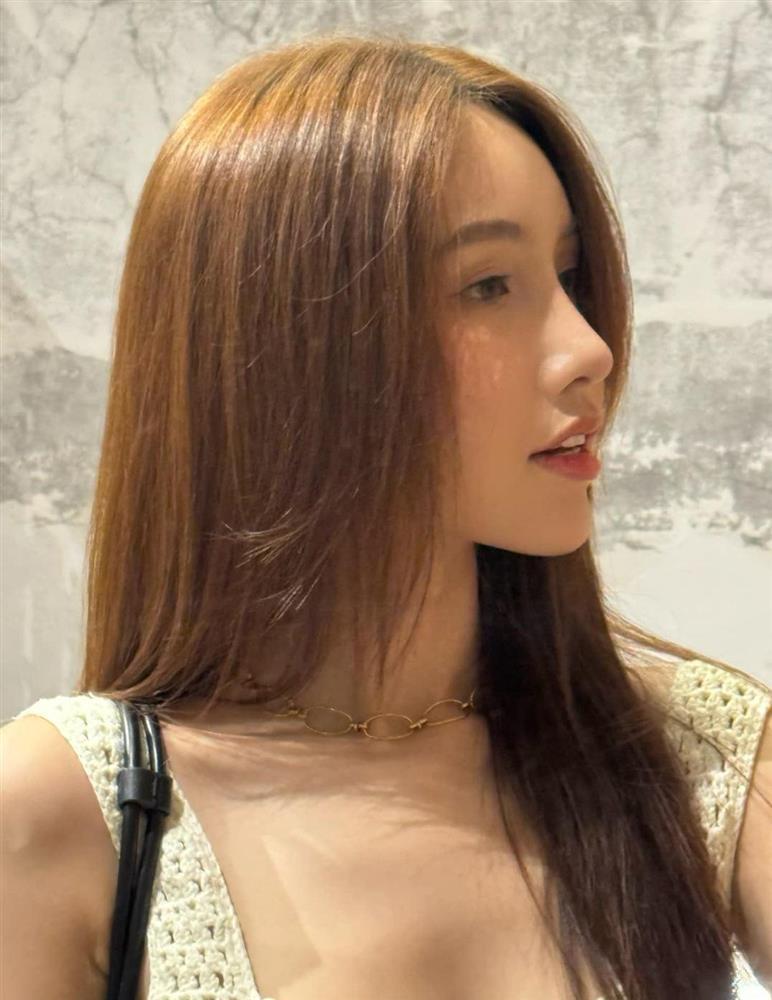 Mỹ nữ kế nhiệm Hương Giang tự công khai quá trình phẫu thuật thẩm mỹ-2