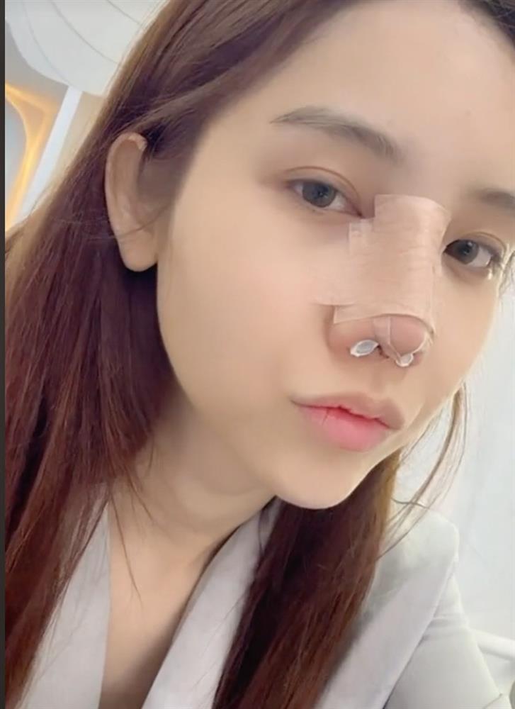 Mỹ nữ kế nhiệm Hương Giang tự công khai quá trình phẫu thuật thẩm mỹ-4