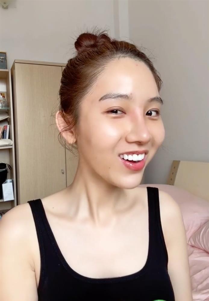 Mỹ nữ kế nhiệm Hương Giang tự công khai quá trình phẫu thuật thẩm mỹ-6