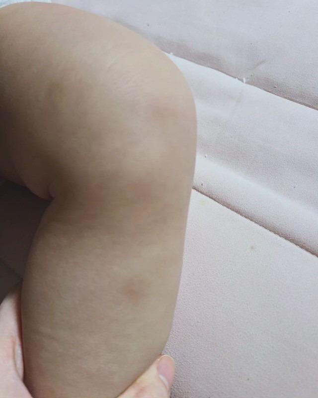 Cựu thành viên T-ara tung ảnh bị chồng cũ bạo hành-6