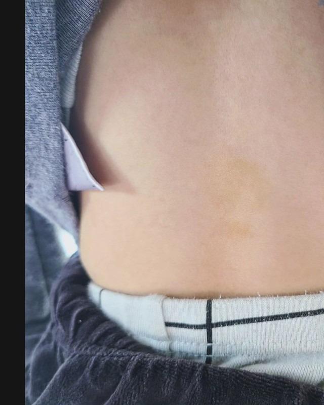 Cựu thành viên T-ara tung ảnh bị chồng cũ bạo hành-7