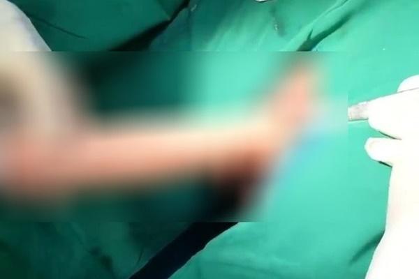 Người đàn ông gặp họa chỉ vì độ của quý-2