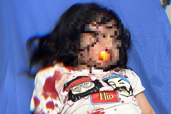 Đâm 3 người hàng xóm ở TPHCM thương vong vì chuyện chó phóng uế bậy-2