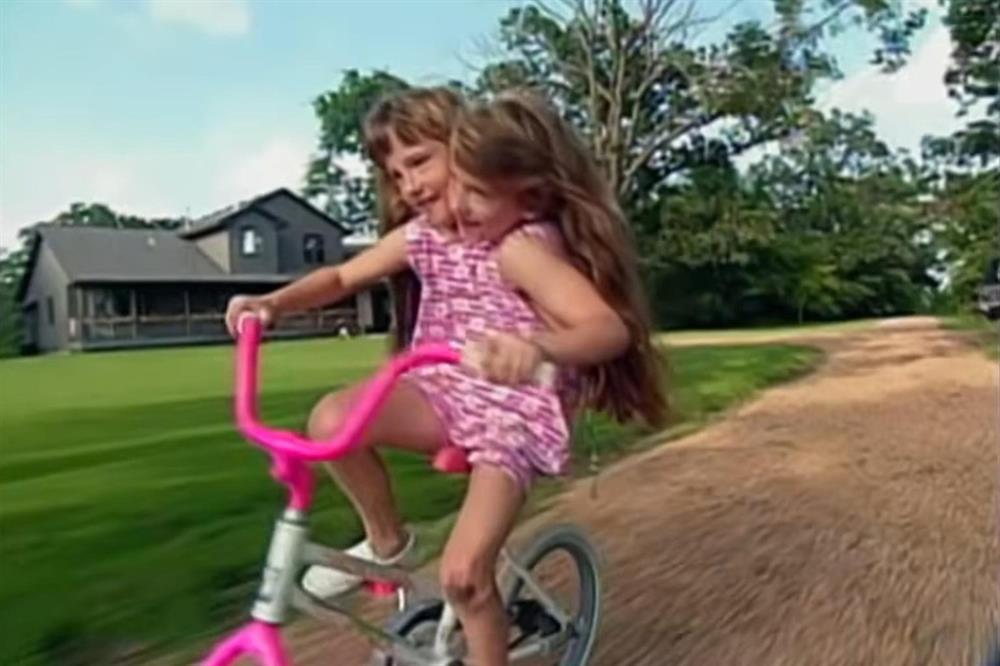 Cặp song sinh hai đầu, một thân đã kết hôn-4