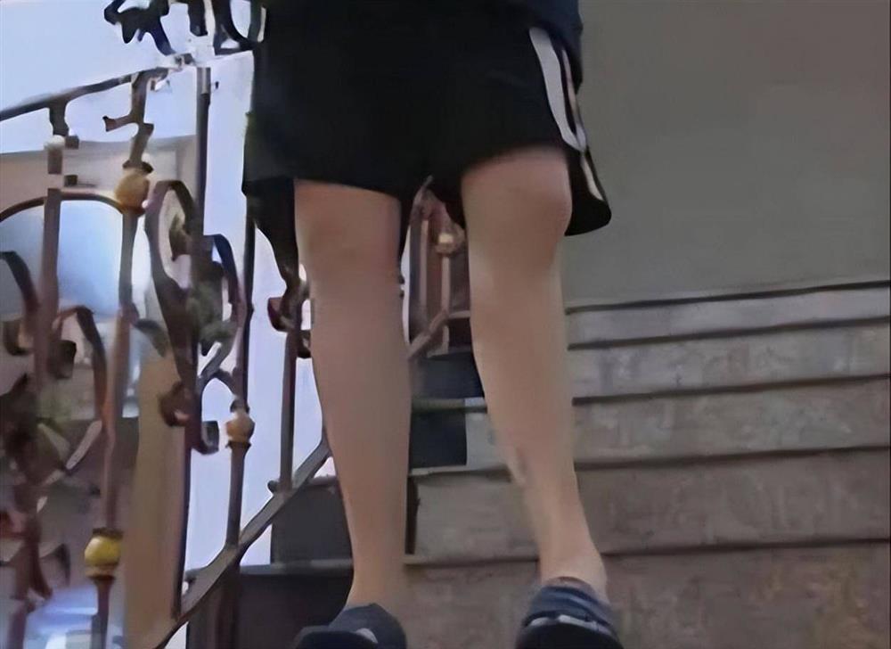 Chàng trai chi nửa tỷ để tăng chiều cao thêm 7cm, cái kết khiến ai cũng sợ hãi-5