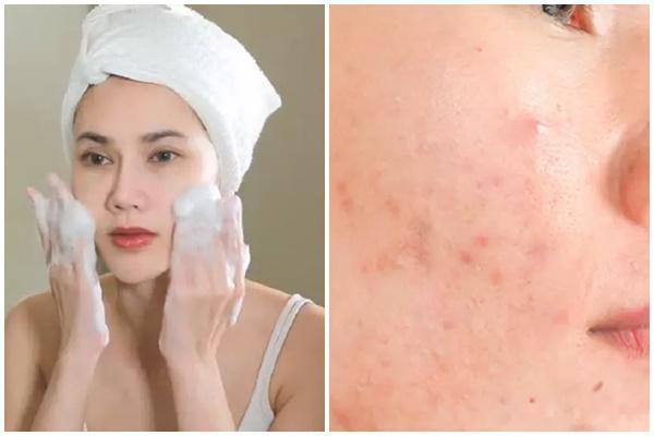 Chu trình chăm sóc da của Gen Z có gì hay ho?-3