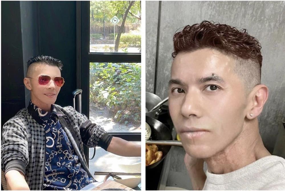 Kasim Hoàng Vũ từng nổi tiếng thế nào trước khi khiến khán giả sốc vì hình ảnh gầy gò, ốm yếu ở Mỹ?-1