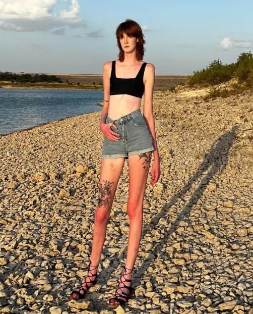 Cuộc sống của cô gái 21 tuổi có đôi chân dài nhất thế giới-2