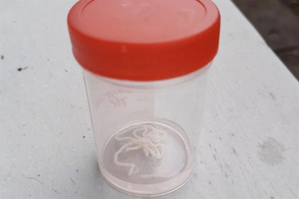 Giun lúc nhúc trong người vì ăn ếch, cá theo kiểu này-2