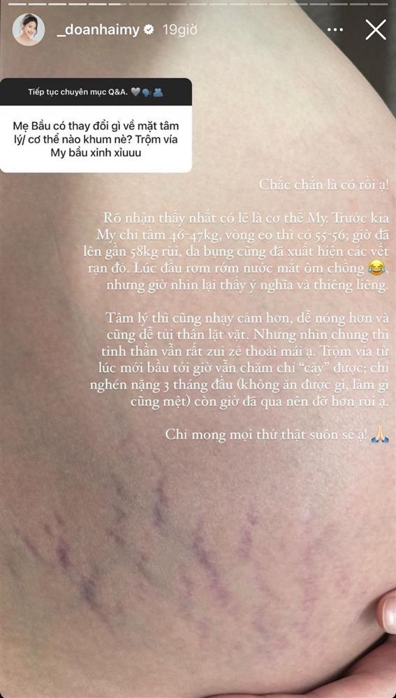 Doãn Hải My vướng nỗi ám ảnh của người mang bầu-3