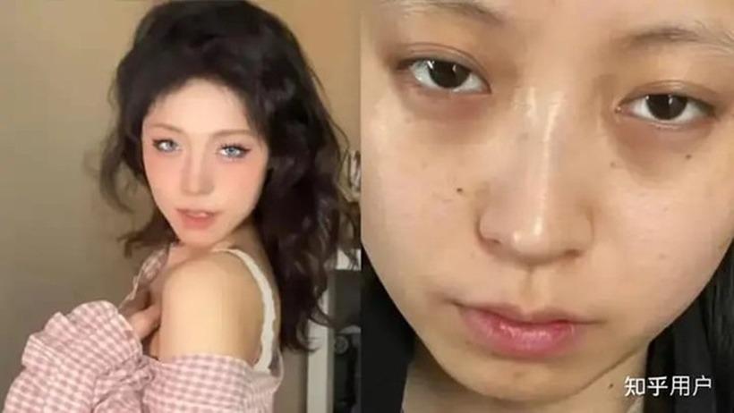 Ngoại hình xuống sắc sau 1 năm đi làm, cô gái được công ty bồi thường hơn 30 triệu để làm đẹp-1