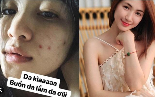 Hòa Minzy tiết lộ loại rau giúp làn da cô trắng mịn, mùa hè người Việt nên ăn để thải độc và kéo dài tuổi thọ-1