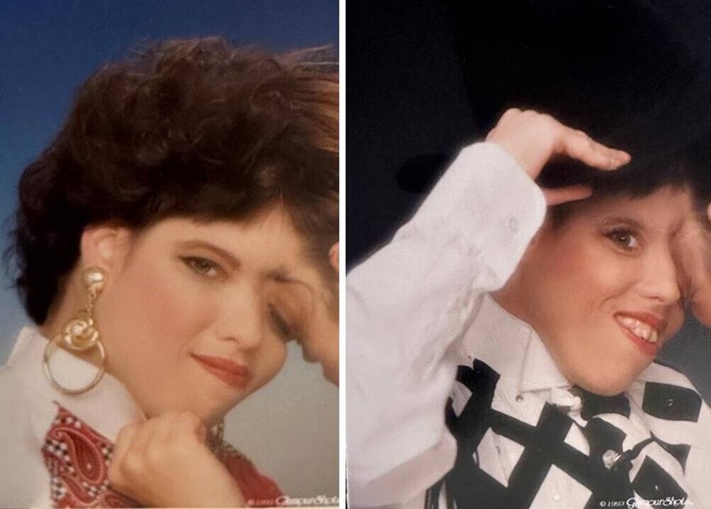 Cặp song sinh dính liền lớn tuổi nhất thế giới vừa qua đời-2