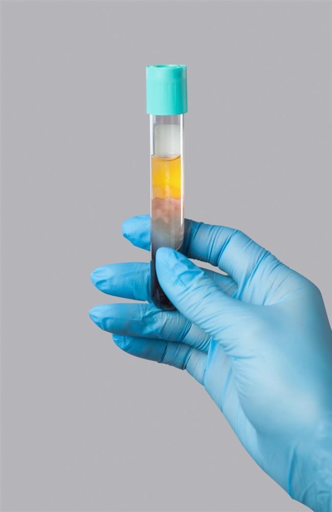 Chuyên gia cơ xương khớp cảnh báo hậu quả tự dùng thuốc giảm đau-2