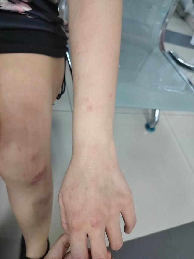 Bị chồng bạo hành dã man, vợ gọi cho người yêu cũ cầu cứu và cái kết bất ngờ gây xôn xao-2