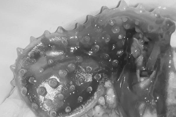 Cô gái bị mắc kẹt bảo hộ trong vùng kín suốt 3 tuần chỉ vì bạn trai thay đổi chiến thuật-1