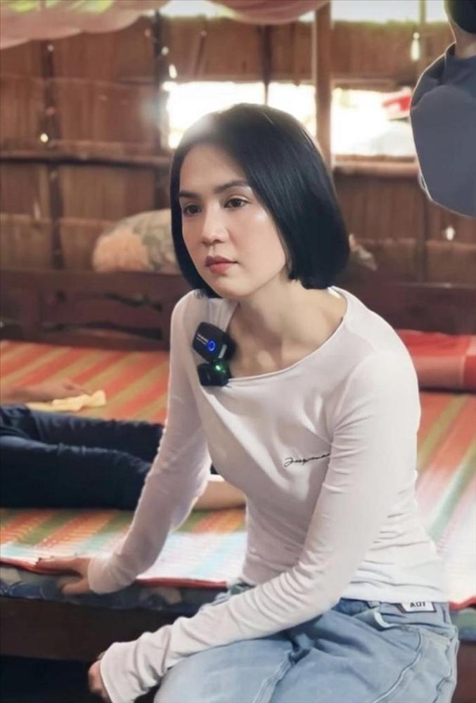 Ngọc Trinh điều trị những vết tích do tai nạn mô tô để lại-1