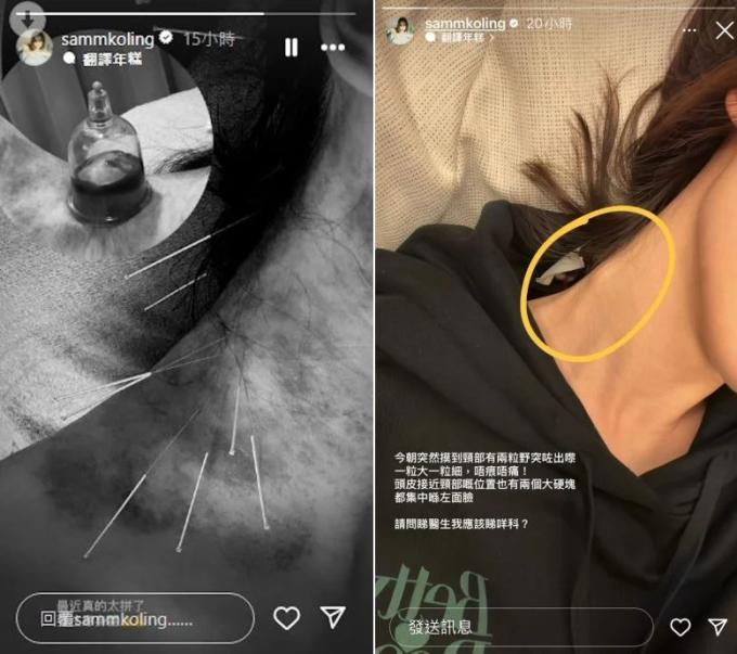 Mỹ nhân cảnh nóng TVB Cao Hải Ninh gặp vấn đề sức khỏe, nhập viện sau khi phát hiện khối u bất thường-2