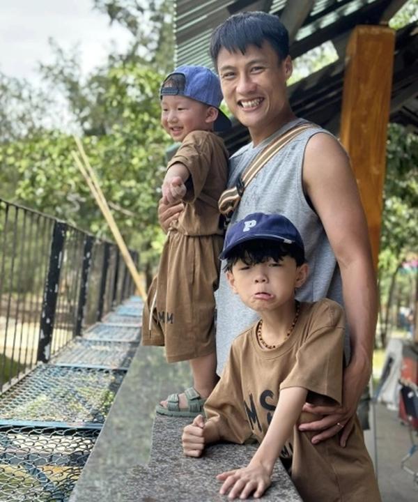 Vợ Mạc Hồng Quân tiết lộ diện mạo thời thẩm mỹ hỏng, phải chi 90 triệu sửa mũi lần 4, từng sợ chồng bỏ vì khuôn mặt biến dạng-9