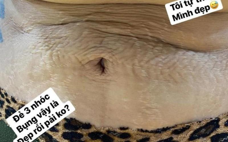 Mỹ nhân Việt không ngại khoe vết rạn sau sinh: Người tự hào, người rơi nước mắt-11