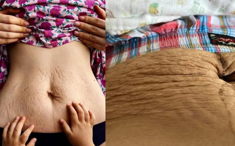 Mỹ nhân Việt không ngại khoe vết rạn sau sinh: Người tự hào, người rơi nước mắt-7