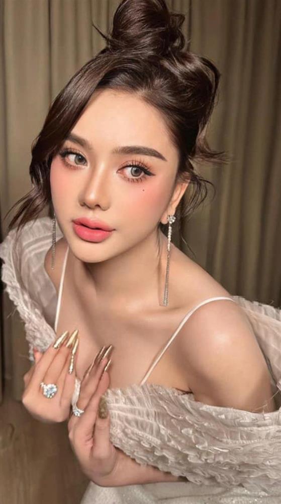 Lâm Khánh Chi bị hải quan giữ 2 lần hậu phẫu thuật thẩm mỹ, chi 3 tỷ mua liệu trình làm đẹp-4