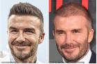 Bác sĩ thẩm mỹ gọi tên 5 tài tử tiêm chất làm đầy, có cả Beckham và Tom Cruise
