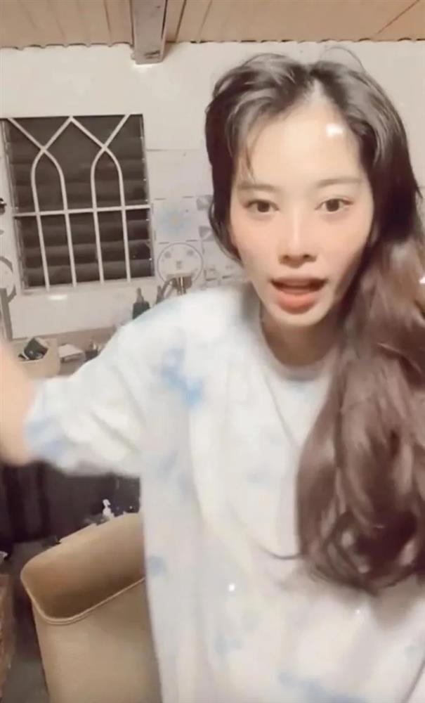 Vừa thừa nhận dao kéo, Nam Em tiếp tục kể chuyện thẩm mỹ hỏng, nhan sắc ngày càng tiều tụy-5