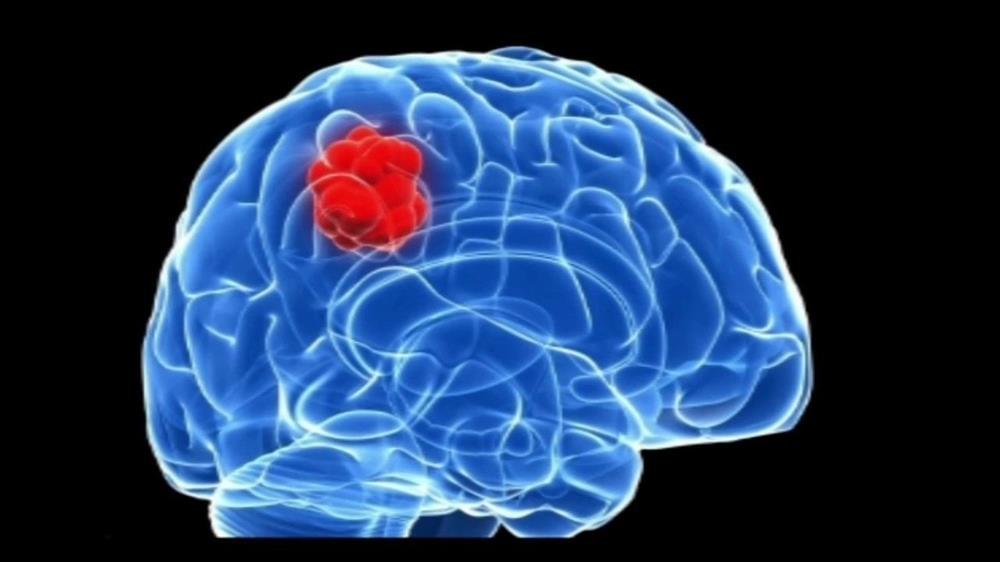 Ca sĩ Lương Bích Hữu phát hiện khối u trong não sau tai nạn: Tình hình sức khỏe mới nhất-1