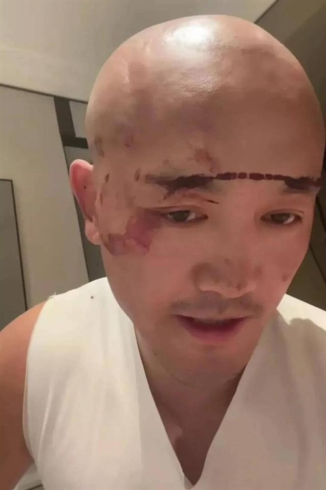 Vì sao võ sư Trung Quốc tự xưng đệ nhất Thiếu Lâm trở mặt đối đầu cả môn phái?-3