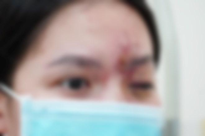 Bàng hoàng chủ cơ sở spa tiêm nhầm sữa rửa mặt vào da cho khách-2