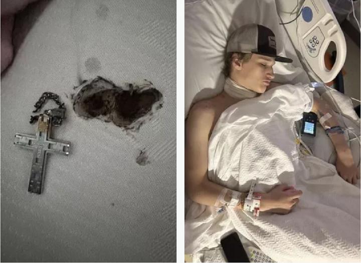 Vòng cổ khiến thiếu niên bị điện giật suýt chết, cổ mang sẹo hình dây chuyền-3