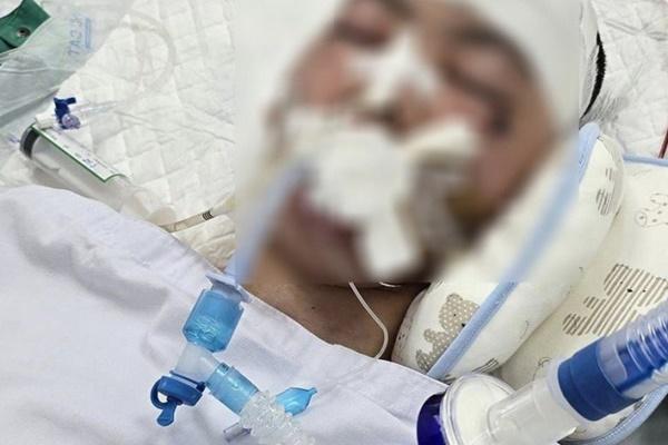 Nam sinh lớp 8 ở Hà Nội bị đánh chấn thương sọ não đã tử vong-1