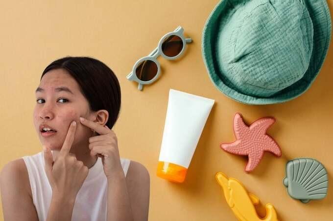 5 lý do sử dụng kem chống nắng bị nổi mụn-1