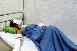 Tấn công bằng a-xít ở TPHCM, 1 người chết, nhiều người bị thương