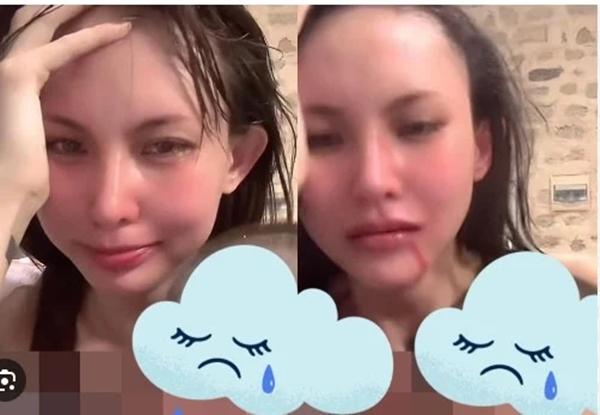 Mỹ nhân công khai bị bạo hành: Người chấn thương sọ não, người hoảng loạn không lối thoát-2