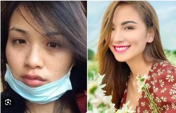 Mỹ nhân công khai bị bạo hành: Người chấn thương sọ não, người hoảng loạn không lối thoát-3