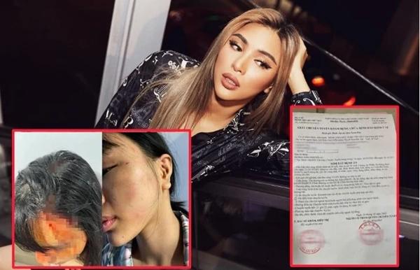 Mỹ nhân công khai bị bạo hành: Người chấn thương sọ não, người hoảng loạn không lối thoát-4