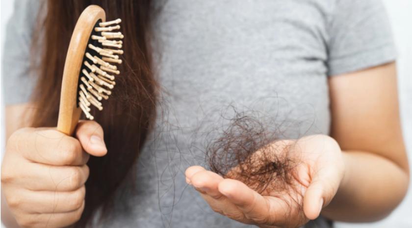 Bác sĩ chỉ ra 4 yếu tố gây rụng tóc ở phụ nữ mà không phải ai cũng biết-1