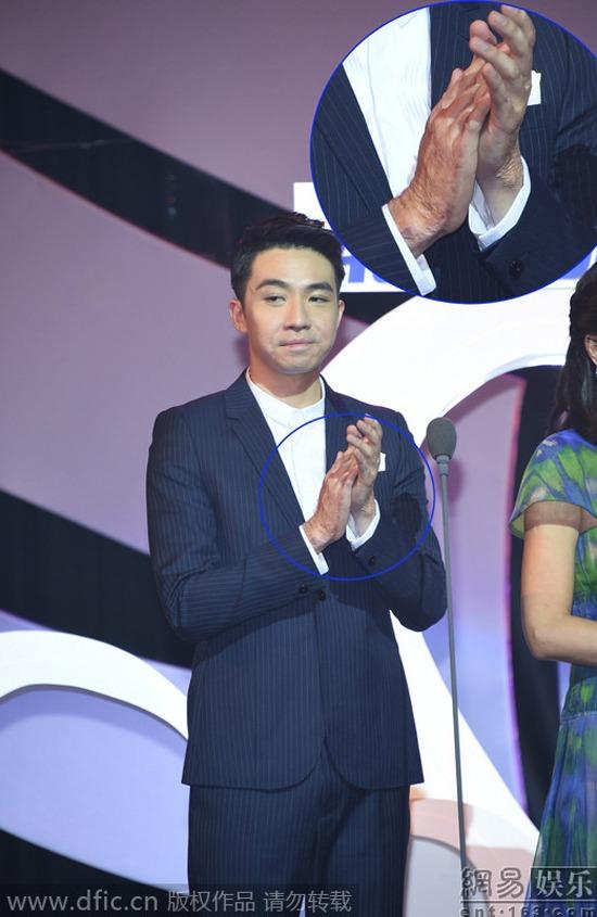 Loạt diễn viên bị hủy hoại dung nhan, thiệt mạng do tai nạn phim trường-7