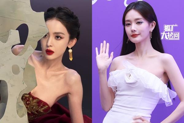 Cô gái cao 1m60, nặng 25kg, thân hình gầy trơ xương nhưng vẫn tiếp tục giảm cân: Bác sĩ cảnh báo đỏ-4