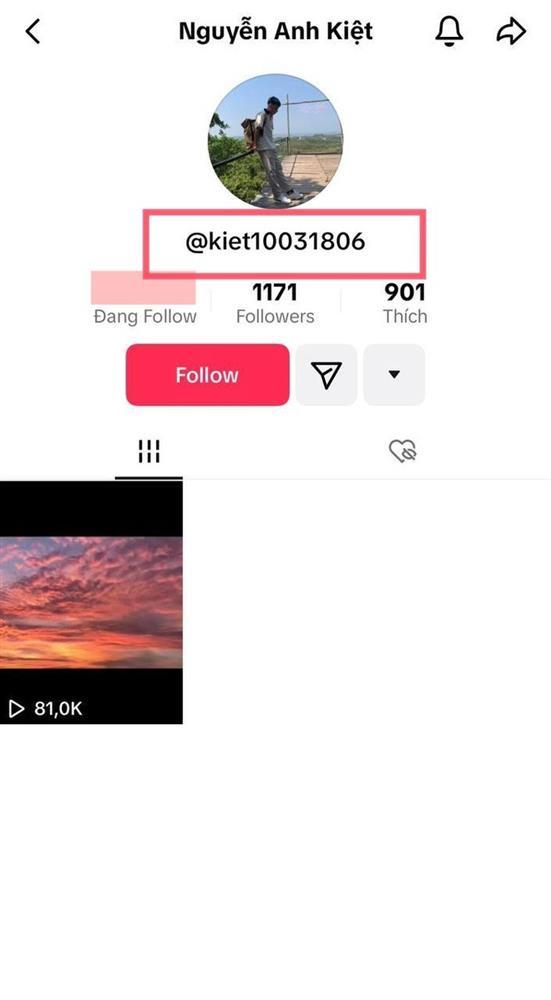 Bạn trai Hoa hậu Ý Nhi bị phát hiện 1 chi tiết đặc biệt, hoá ra đây là thái độ trong 1 năm yêu xa?-1