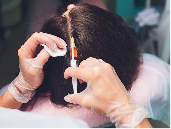 Cấy tóc có an toàn không?-1