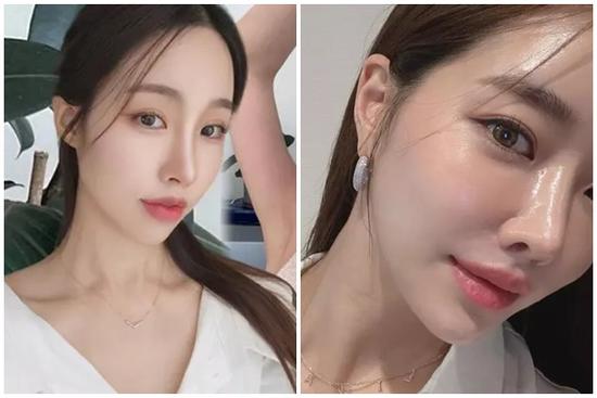 Thói quen đơn giản giúp ngăn ngừa suy giảm collagen