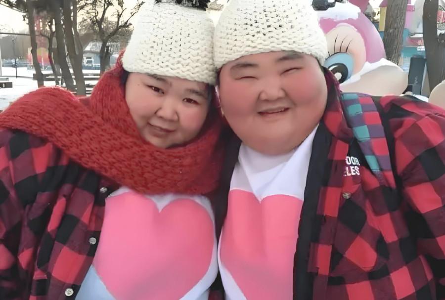 Cặp đôi nặng gần 400kg khao khát có con, chết lặng nghe câu nói của bác sĩ-3