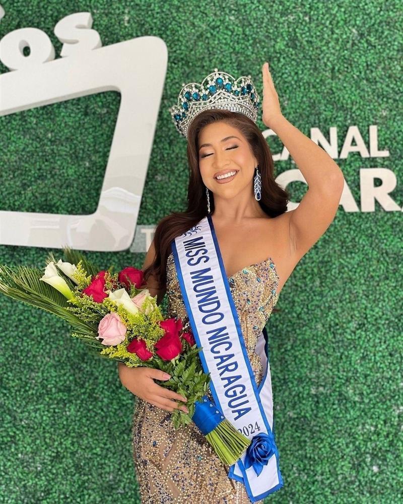 Người đẹp Hoa hậu Thế giới bị nhận xét già nua so với tuổi 20-1