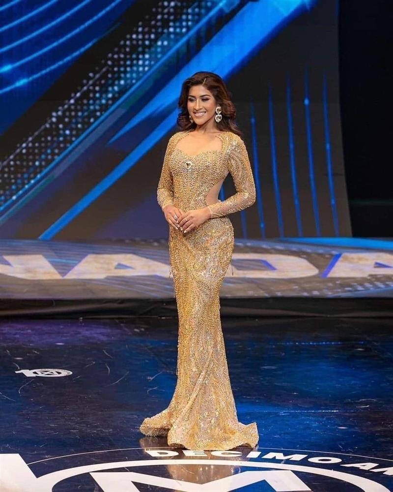 Người đẹp Hoa hậu Thế giới bị nhận xét già nua so với tuổi 20-4