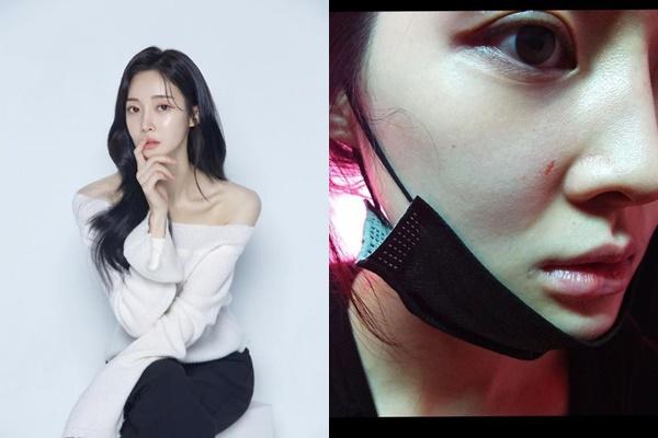 Nóng: Ahreum (T-ara) bị khởi tố hình sự-9