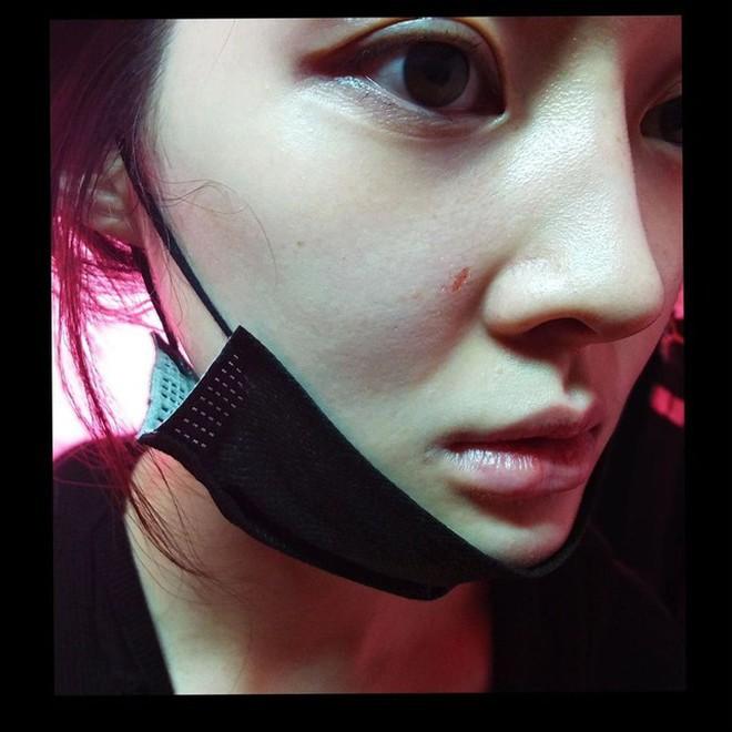 Nóng: Ahreum (T-ara) nhập viện cấp cứu khi bị truy tố-4